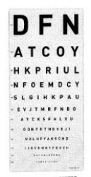 Syntavla DFN 5 m 12 rader 0,1-2,0